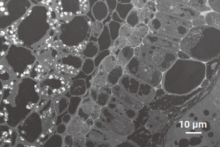 FESEM Microscope Atomic number contrast (Z-contrast) image with Retractable Back-Scattered Electron Detector